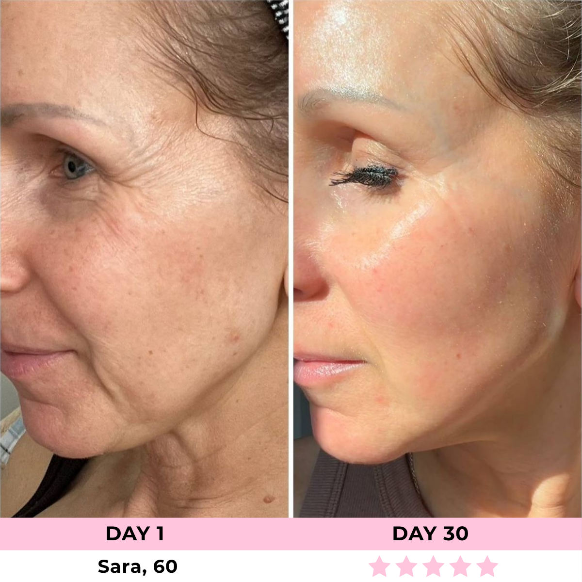 EMILIE™ - LED Face Sculptor