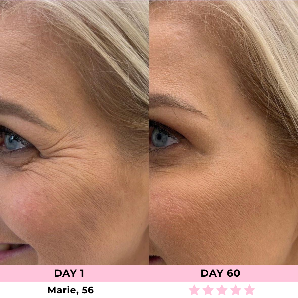 EMILIE™ - LED Face Sculptor